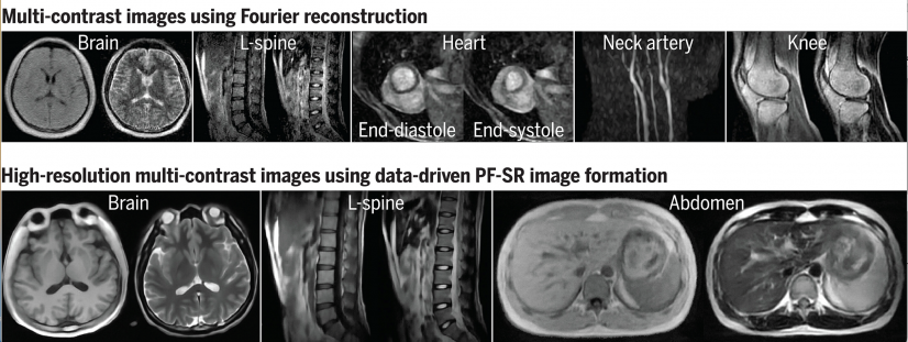(Top) Typical images of various anatomical structures using conventional image reconstruction 
(Bottom) High-resolution images using deep learning image formation by harnessing large-scale high-field MRI data